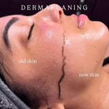 dermaplaning-f35e71af-870e-44e5-bd23-17c8cf80e2f0.jpg